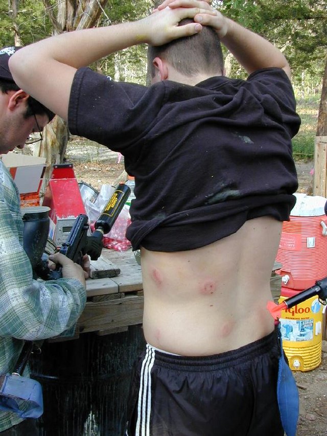 2000-04-brad-back-1.jpg