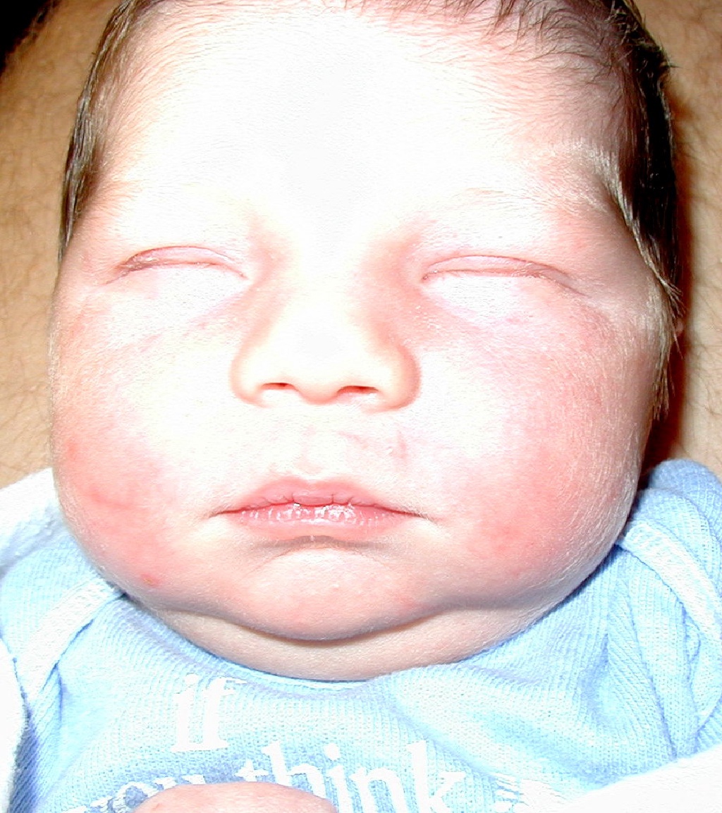 2001-05-09-09-Dax.jpg