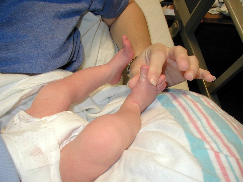 2001-05-09-15-Dax-split-toes-feet.jpg