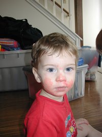 2002-11-11-Dax-jello-face-2.JPG