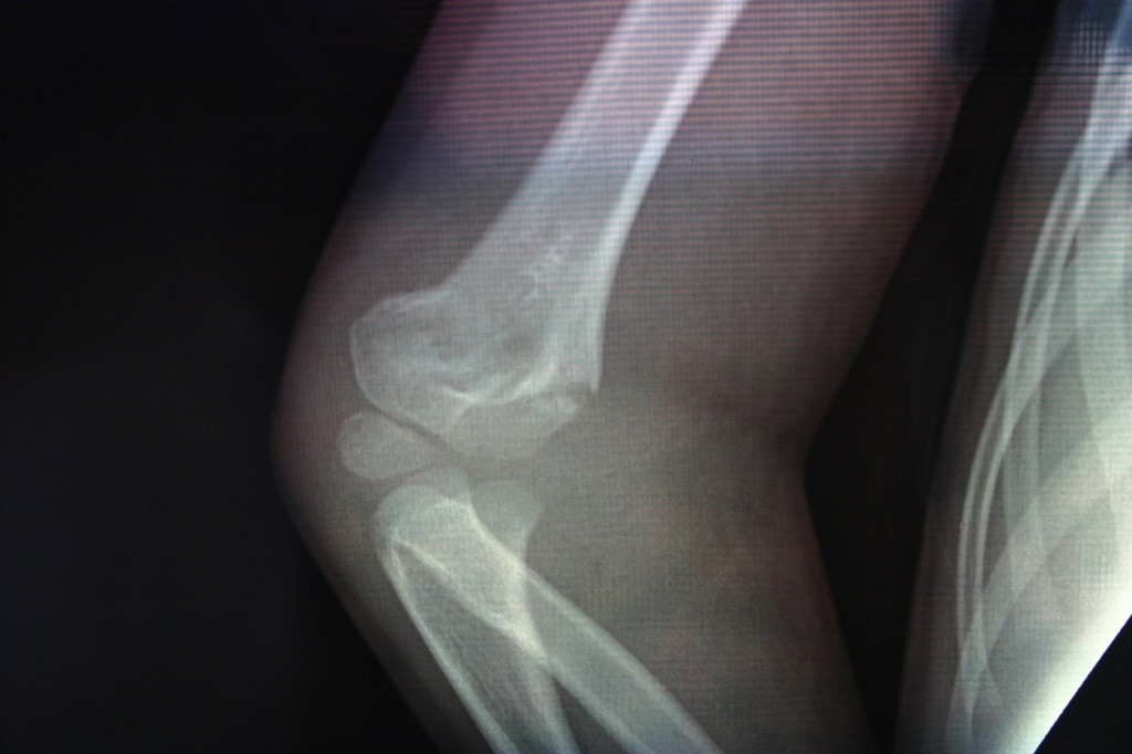 2006/03(March)/Dax-broken-arm/1024x768_2006-03-29-Dax-broken-arm-2.JPG
