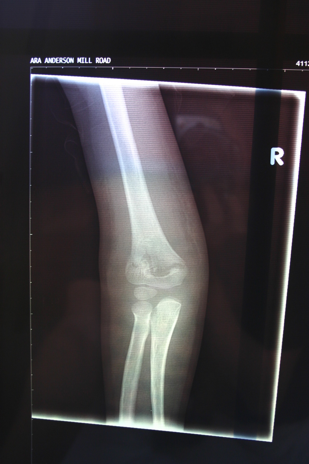 2006/03(March)/Dax-broken-arm/1024x768_2006-03-29-Dax-broken-arm-6.JPG