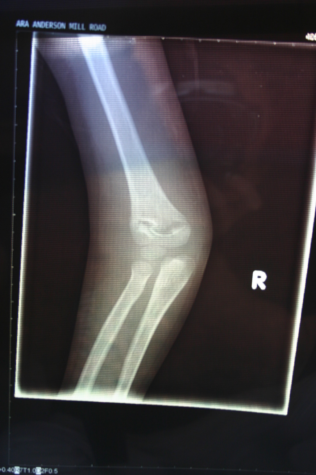 2006/03(March)/Dax-broken-arm/1024x768_2006-03-29-Dax-broken-arm-7.JPG