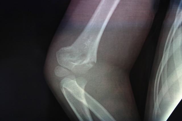 2006/03(March)/Dax-broken-arm/640x480_2006-03-29-Dax-broken-arm-2.JPG