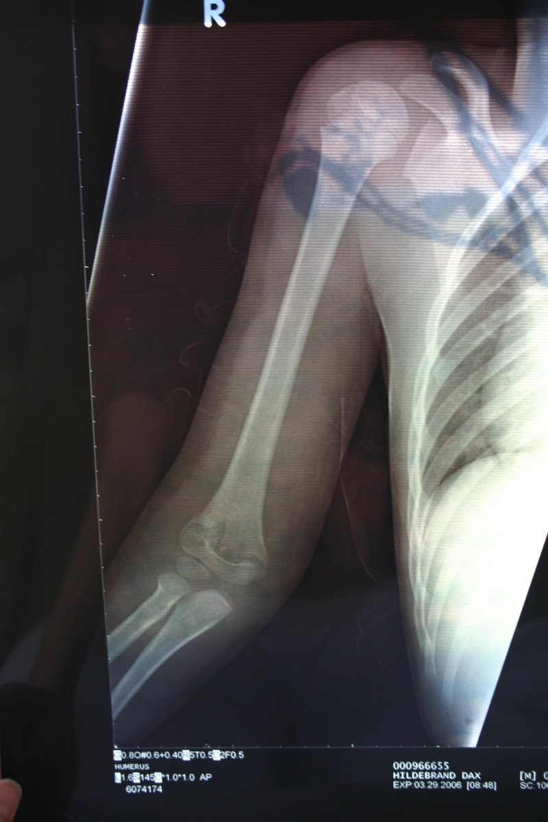 2006/03(March)/Dax-broken-arm/800x600_2006-03-29-Dax-broken-arm-3.JPG