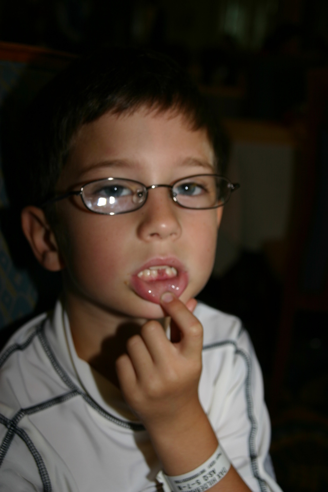 2007/09(September)/2007-Disney-Cruise/Day3/640x480_2007-09-24-Disney-Magic-Cruise-02-Dax-lost-first-tooth.JPG