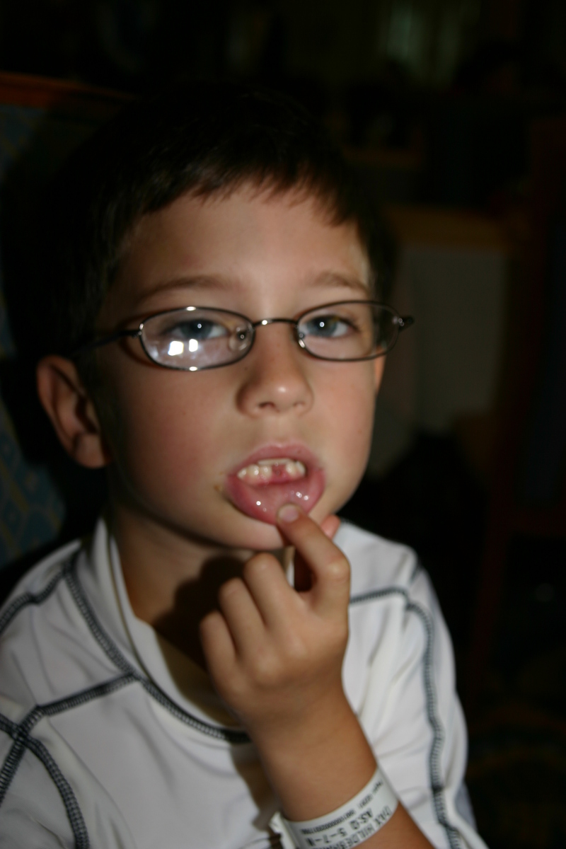 2007/09(September)/2007-Disney-Cruise/Day3/800x600_2007-09-24-Disney-Magic-Cruise-02-Dax-lost-first-tooth.JPG
