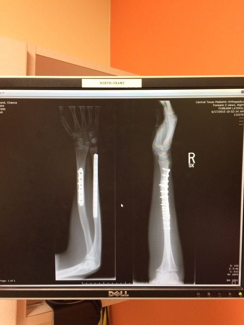 2015/06(June)/Misc/800x600_2015-06-17-Chance-Arm-checkup-2.JPG