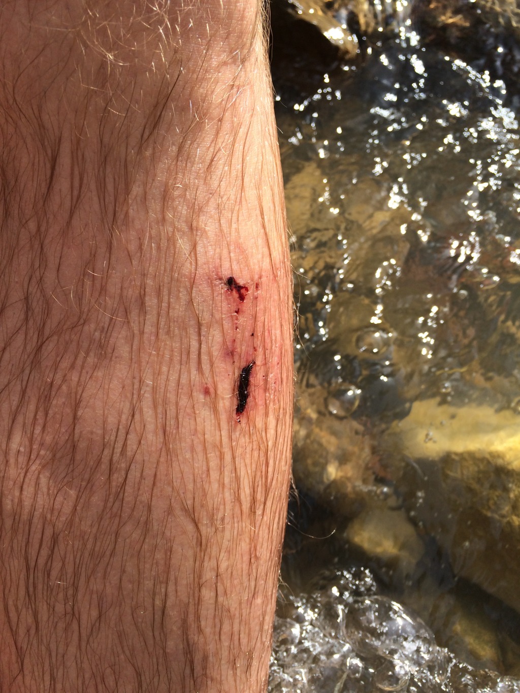 2015-07-10-Philmont-5star-036-Travis-wound-from-fall.jpg