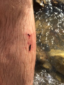 2015-07-10-Philmont-5star-036-Travis-wound-from-fall.jpg
