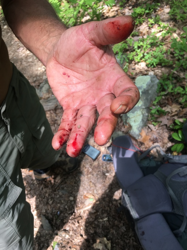 2016-05-26-Appalachian-Trail-260-hiker-got-bit-by-a-rat-snake-high-as-a-kite.JPG