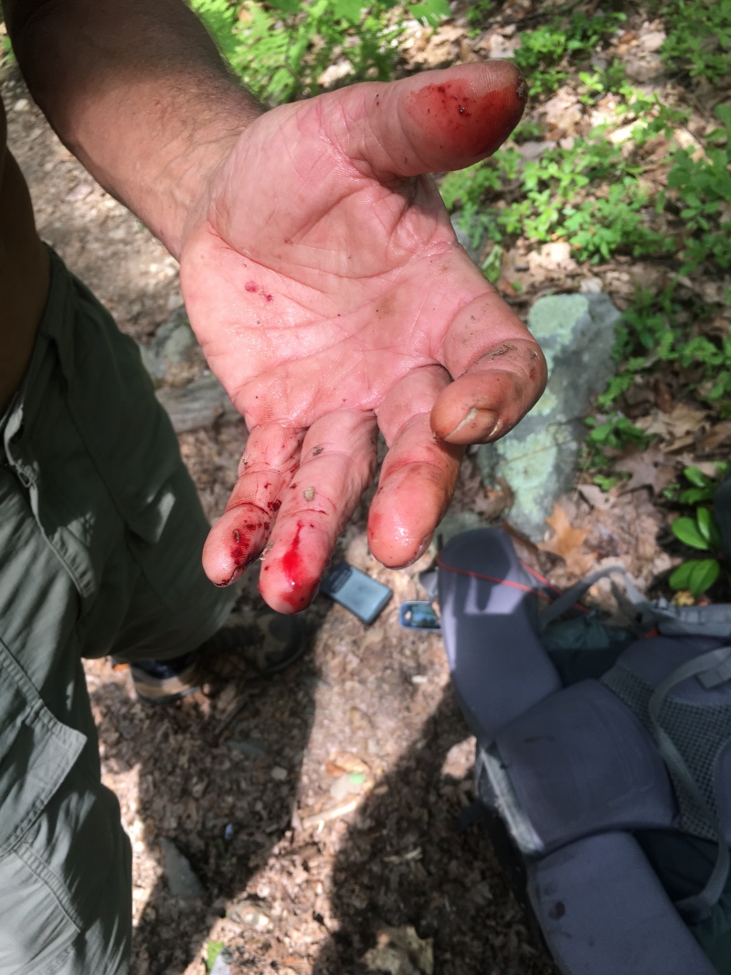2016-05-26-Appalachian-Trail-260-hiker-got-bit-by-a-rat-snake-high-as-a-kite.JPG