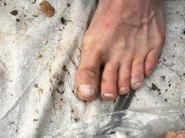 2016-03-30-Appalachian-Trail-048-Chaos-blister.JPG