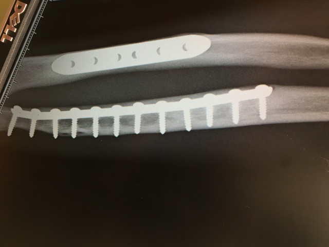 2016/09(September)/Misc/640x480_2016-09-14-Chance-Broken-Arm-Three-1.JPG