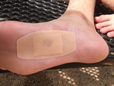 2017-03-15-Grand-Canyon-Day3-35-Dax-cut-foot.JPG