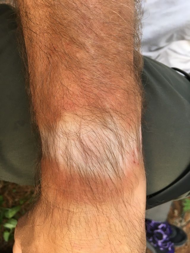 2018-06-18-Northern-Tier-Crew8787-30-watch-tan-lines.JPG