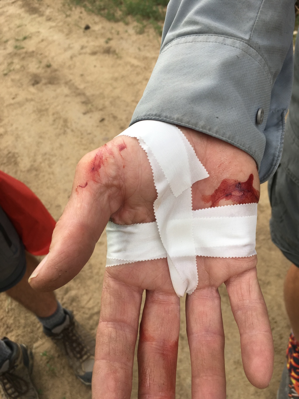 2019-06-19-Philmont-Crew8787-30-Carl-busted-hand.JPG