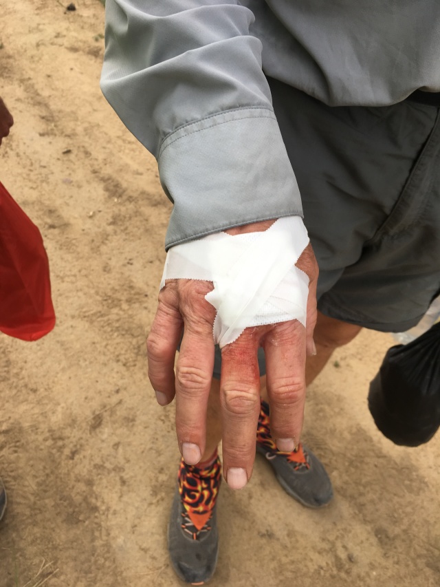 2019-06-19-Philmont-Crew8787-29-Carl-busted-hand.JPG