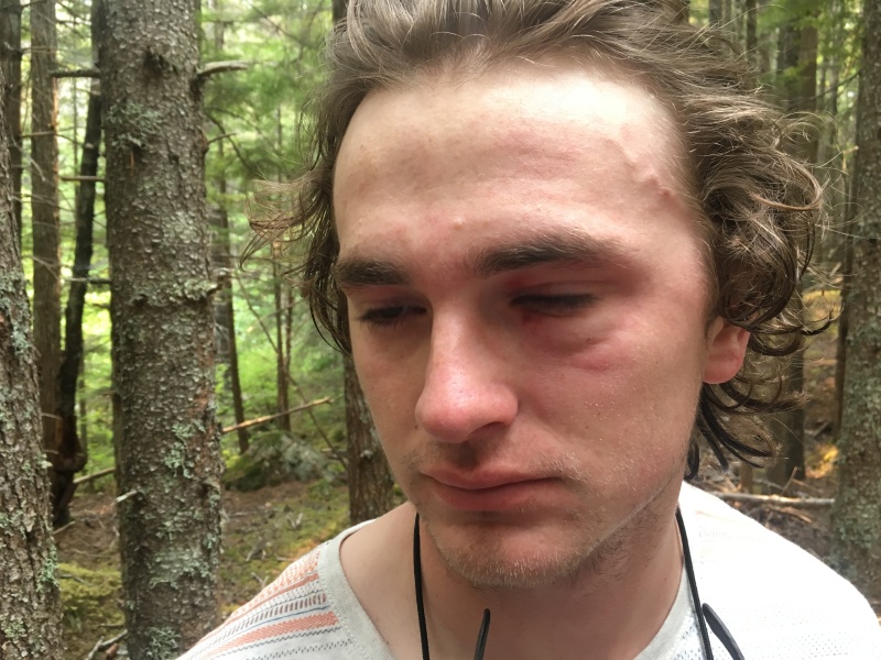 2019-07-10-50th-anniversary-cruise-Skagway-15-Vale-hurt-eye-jumping-into-water.JPG