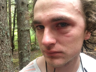 2019-07-10-50th-anniversary-cruise-Skagway-14-Vale-hurt-eye-jumping-into-water.JPG