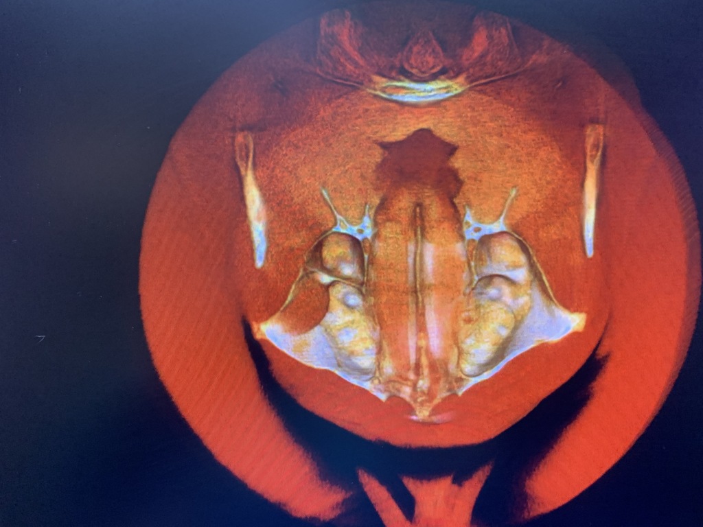 2020/01(January)/Travis-Dental-implant/2020-01-22-Travis-Dental-implant-1-Xrays.JPG