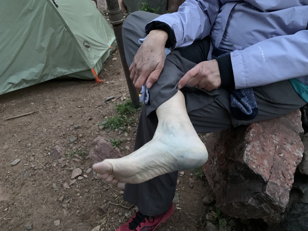 2020-03-19-Grand-Canyon-Crew8787-133-Terry-purple-foot.JPG