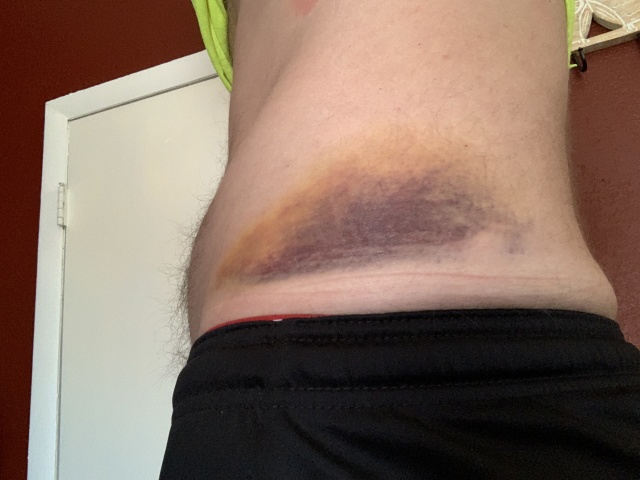 2020-07-08-Colorado-SUP-Blue-River-Travis-Bruise-Day-3.JPG