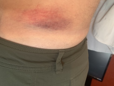 2020-07-06-Colorado-SUP-Blue-River-Travis-Bruise-Day-1.JPG