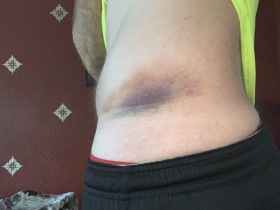 2020-07-07-Colorado-SUP-Blue-River-Travis-Bruise-Day-2.JPG