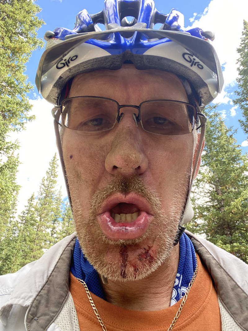2021-08-23-Mt-Guyot-44-Travis-crashed-faceplant.jpg