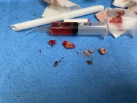 2022/01(January)/Dentist-Implant/2022-01-05-Travis-Dental-Implant-1.JPG