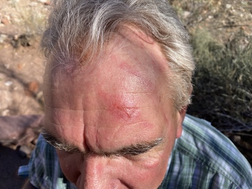 2022-03-14-Grand-Canyon-078-Guy-head-injury.JPG