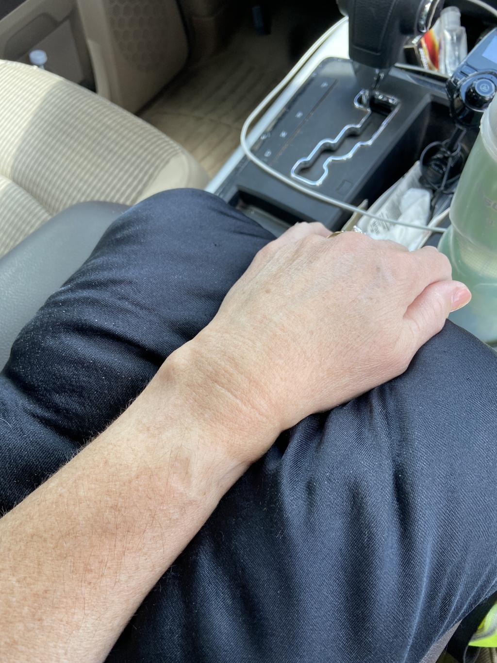 2022/06(June)/Suzi-Broken-Arm/2022-06-12-Suzi-Broken-Arm-scraped-knee-01.JPG