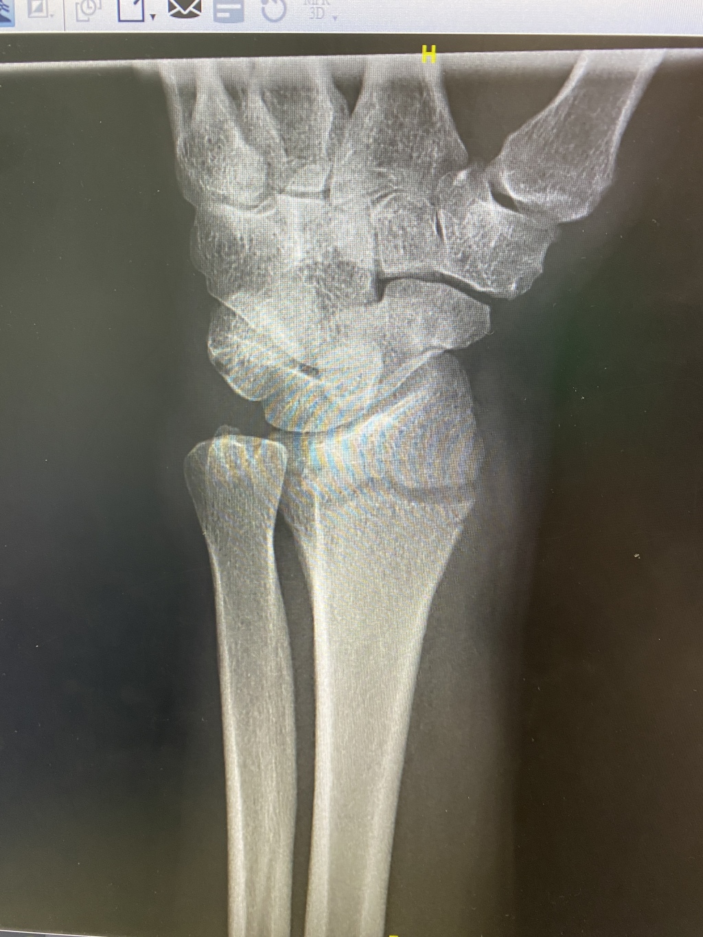 2022/06(June)/Suzi-Broken-Arm/1024x768_2022-06-12-Suzi-Broken-Arm-scraped-knee-05.JPG