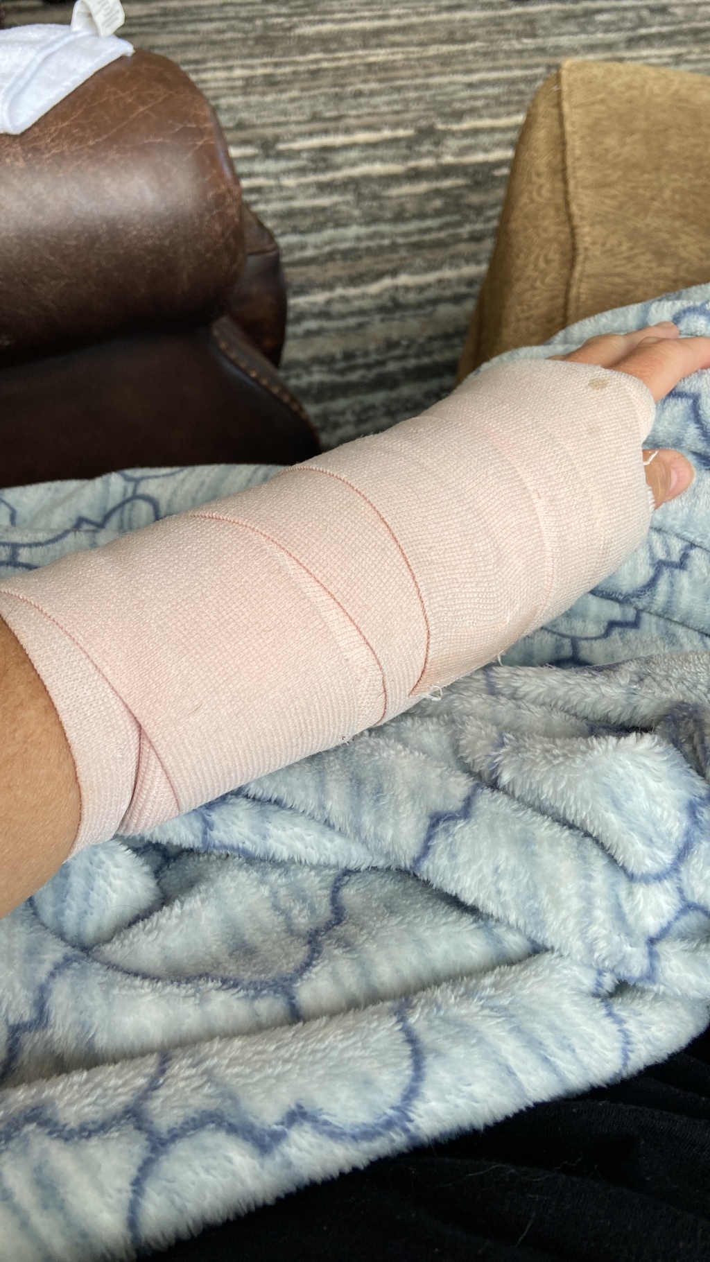 2022/06(June)/Suzi-Broken-Arm/1024x768_2022-06-26-Suzi-Broken-Arm-scraped-knee-18.JPG