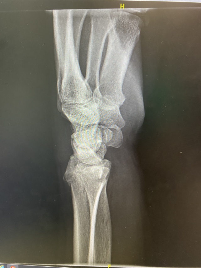 2022/06(June)/Suzi-Broken-Arm/640x480_2022-06-12-Suzi-Broken-Arm-scraped-knee-06.JPG