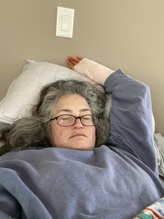 2022/06(June)/Suzi-Broken-Arm/640x480_2022-06-16-Suzi-Broken-Arm-scraped-knee-12.JPG