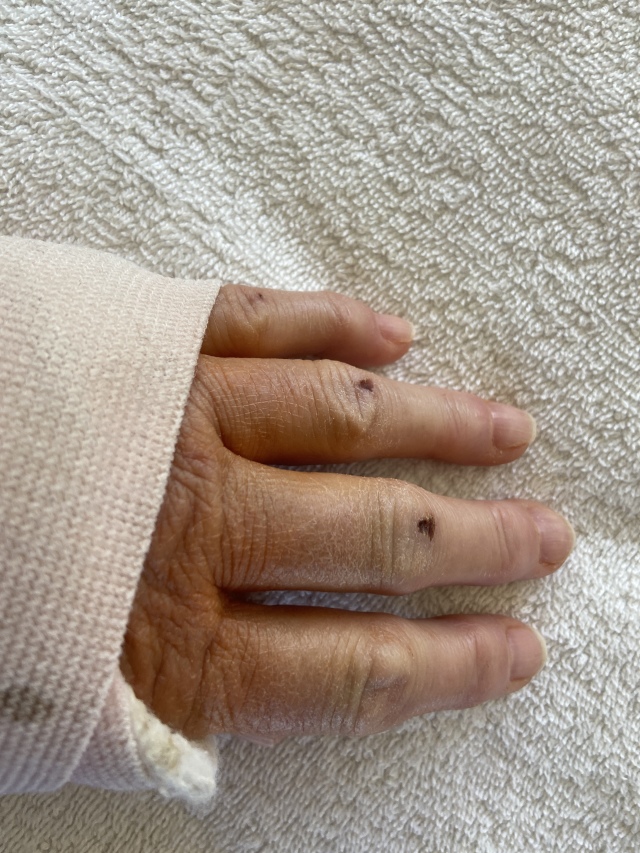 2022/06(June)/Suzi-Broken-Arm/640x480_2022-06-20-Suzi-Broken-Arm-scraped-knee-15.JPG