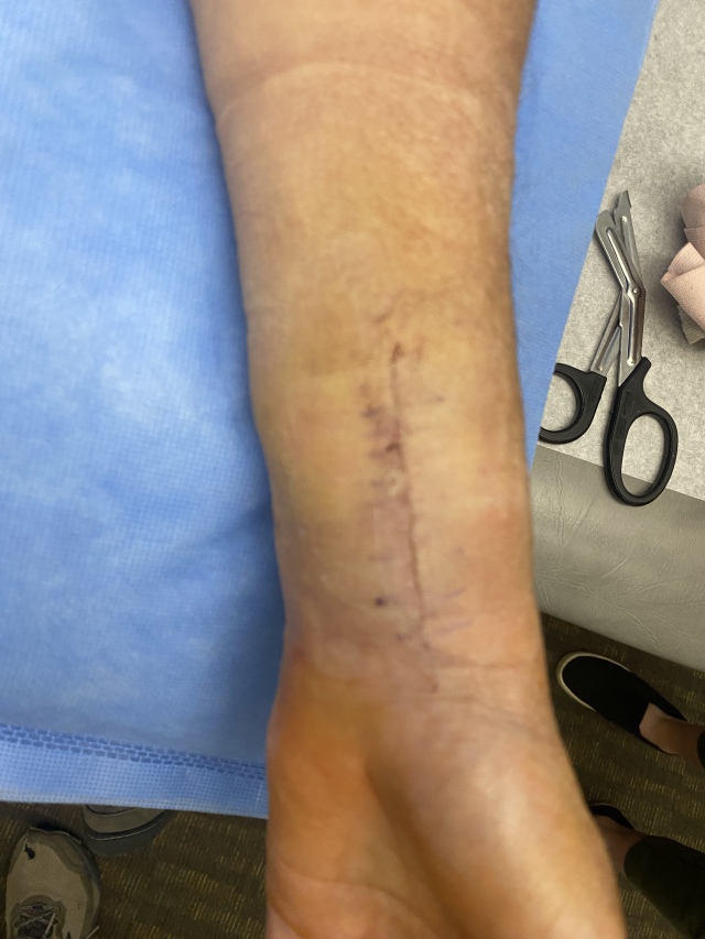 2022/06(June)/Suzi-Broken-Arm/640x480_2022-06-30-Suzi-Broken-Arm-scraped-knee-20.JPG