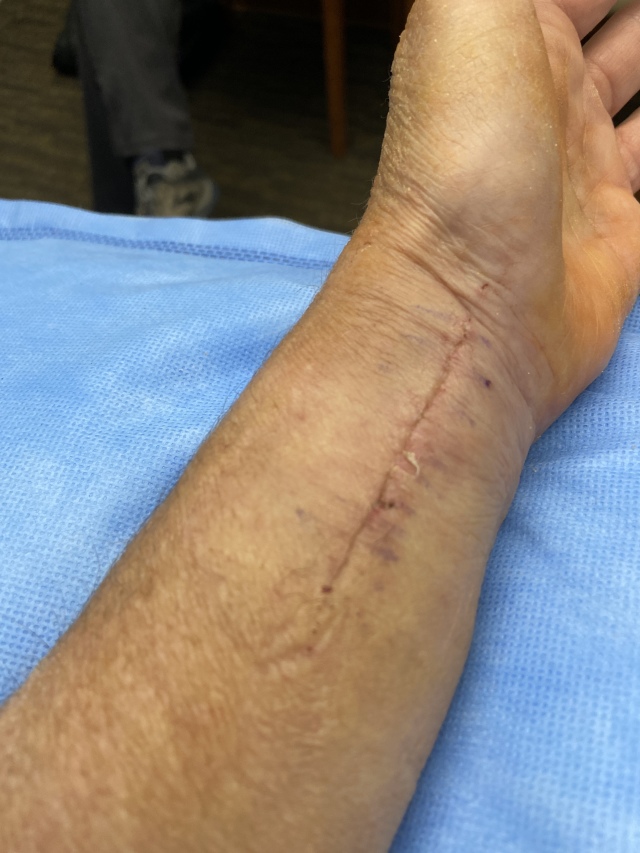 2022/06(June)/Suzi-Broken-Arm/640x480_2022-06-30-Suzi-Broken-Arm-scraped-knee-21.JPG