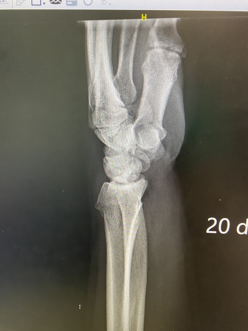 2022/06(June)/Suzi-Broken-Arm/800x600_2022-06-12-Suzi-Broken-Arm-scraped-knee-03.JPG