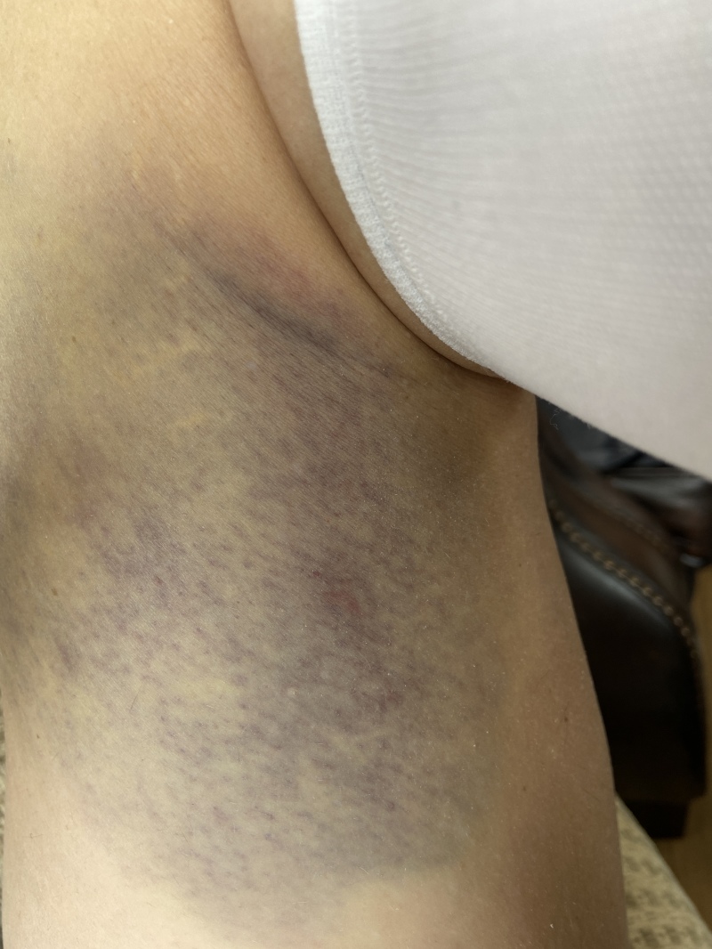 2022/06(June)/Suzi-Broken-Arm/800x600_2022-06-18-Suzi-Broken-Arm-scraped-knee-14.JPG