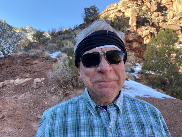 2022-03-14-Grand-Canyon-057-Guy-fell-off-trail-bumped-head-GOOD.JPG