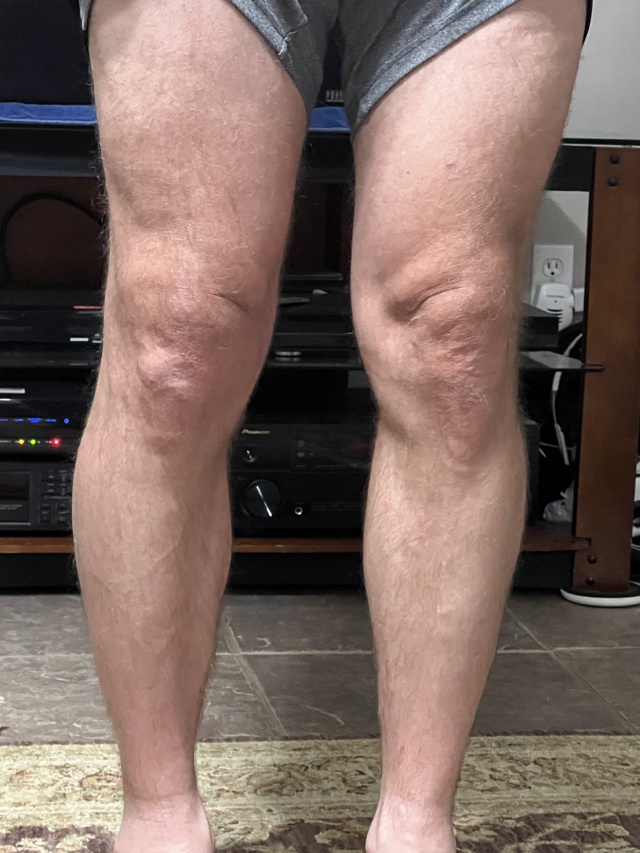 2023/05(May)/Misc/640x480_2023-05-05-Travis-Knees.JPG