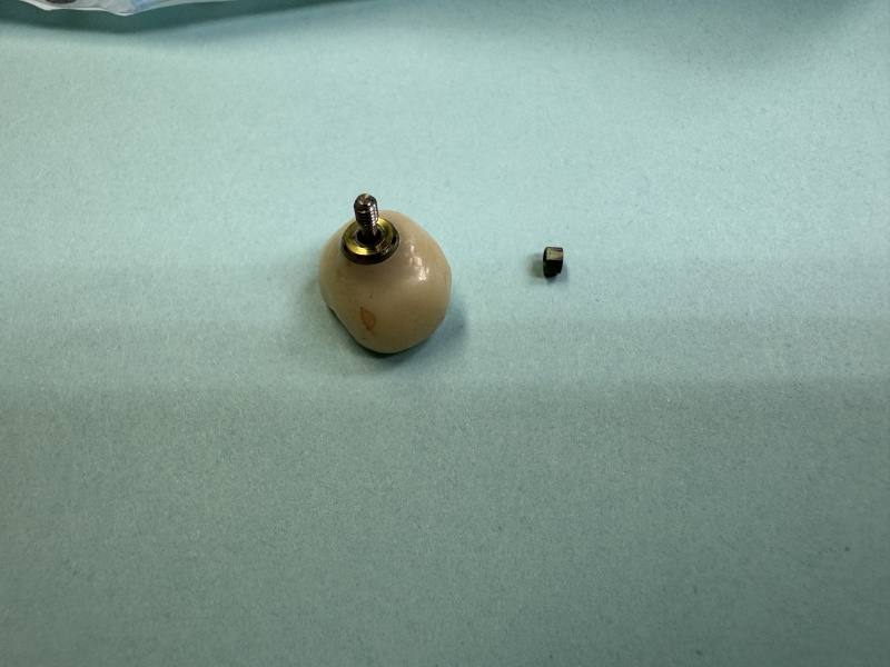 2024/01(January)/Misc/800x600_2024-11-19-Travis-Implant-Lower-Right-6.JPG