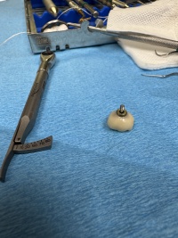 2024-11-19-Travis-Implant-Lower-Right-5.JPG
