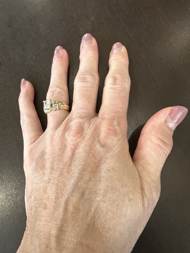 2025/01(January)/Suzi-Hand-Shots/2025-04-18-Suzi-Hand-1.JPG