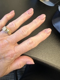 2025-04-21-Suzi-Hand-2.JPG