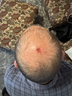 2025-03-14-Colorado-35-Ren-Head-Damage.JPG