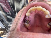 2025-04-13-Pescadero-MX-69-Justin-Stitches.JPG